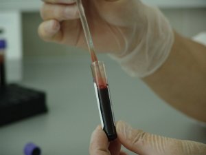 В Ишимбае проведут бесплатное анонимное экспресс-тестирование населения на ВИЧ-инфекцию 